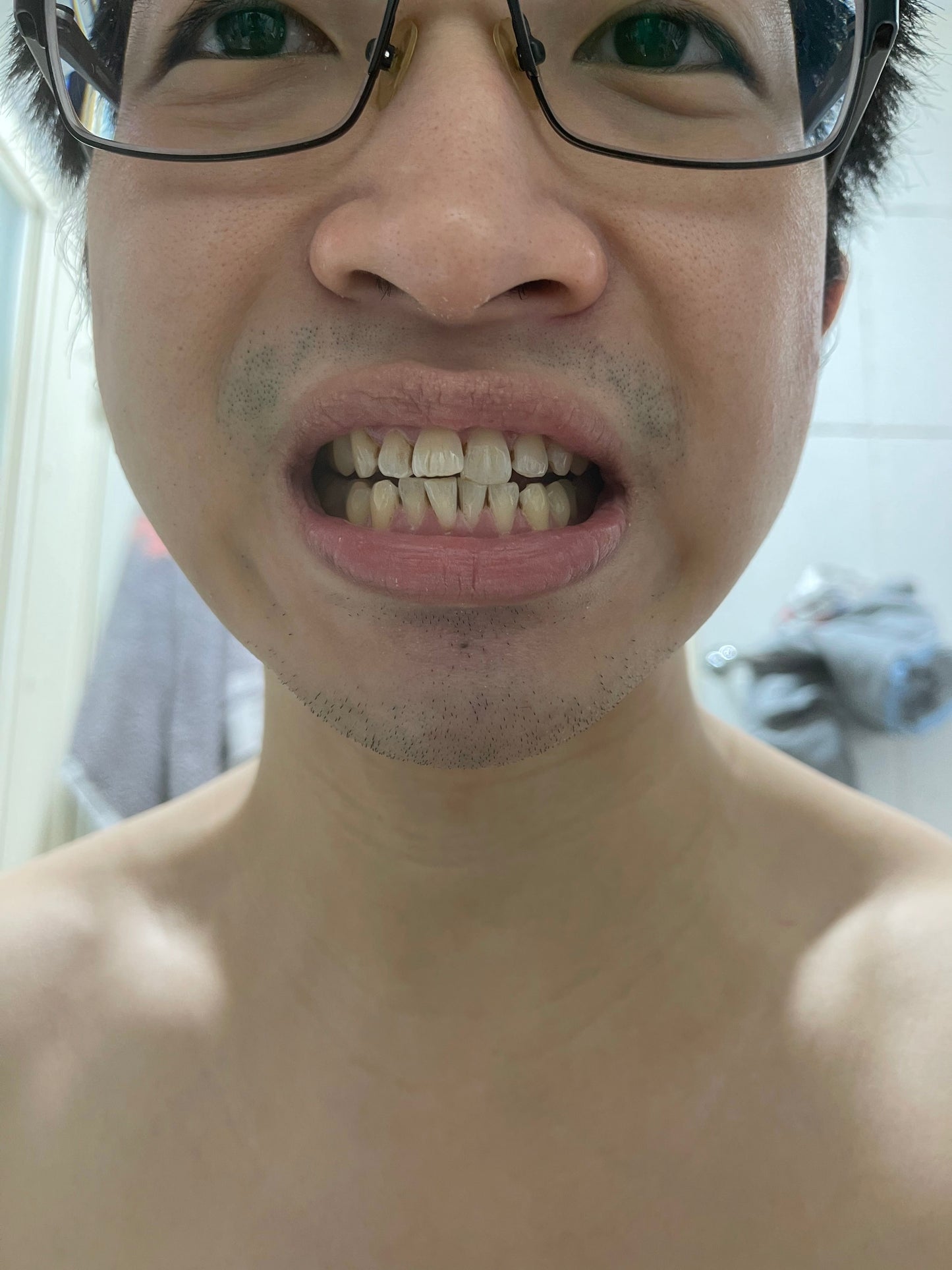 洗牙套裝 (Tooth Cleaning Tools/Teeth Cleaner Tool Kit)