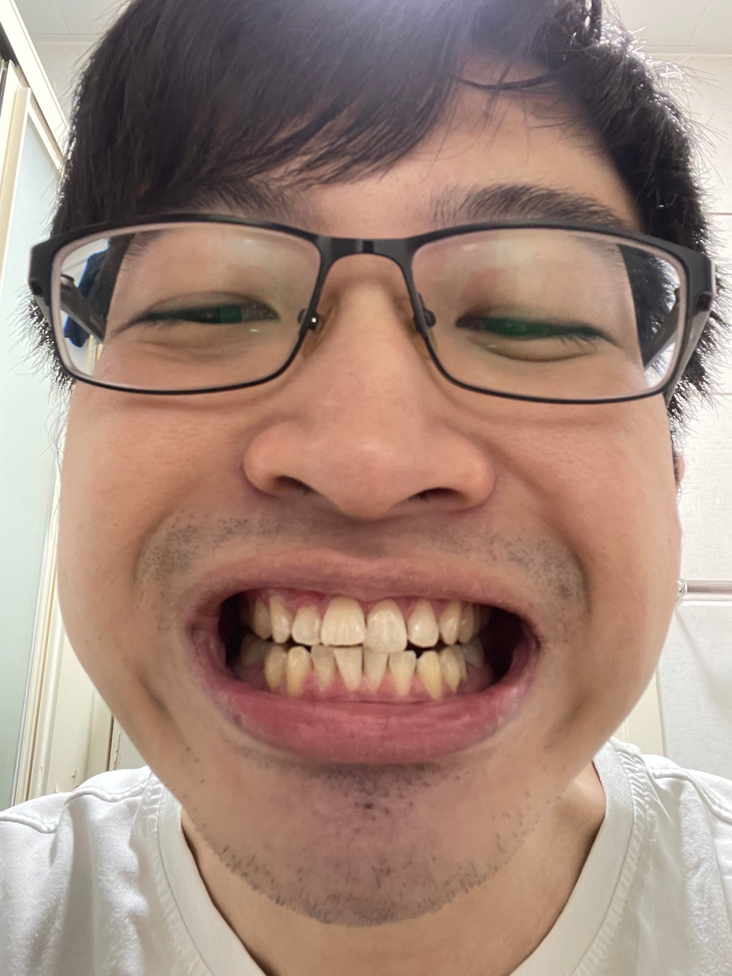 洗牙套裝 (Tooth Cleaning Tools/Teeth Cleaner Tool Kit)